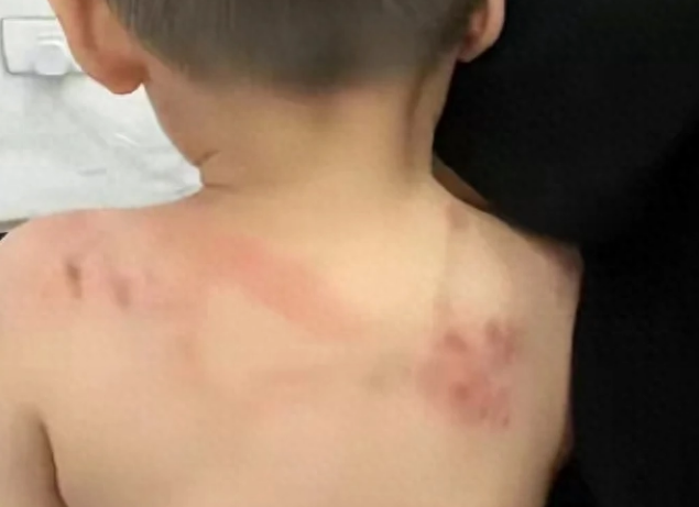 又一起贵州老人带1岁男童回家被恶犬撕咬3分钟,抢救4小时恐残疾 又一起贵州老人带1岁男童回家被恶犬撕咬3分钟,抢救4小时恐残疾