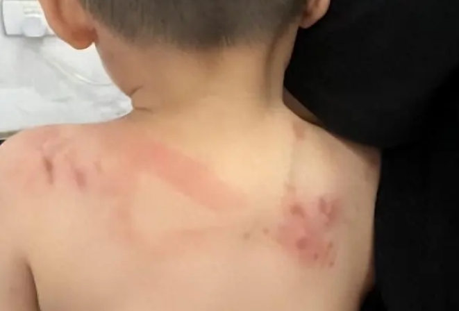 又一起狗咬事件,贵州一岁男童回家被狗撕咬三分钟 又一起狗咬事件,贵州一岁男童回家被狗撕咬三分钟