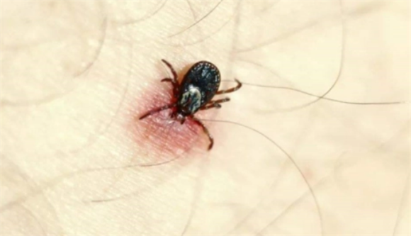 家里杀死蜱虫最彻底的方法