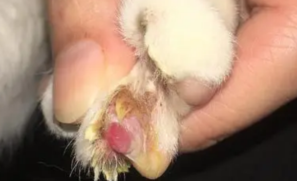 脚趾甲紫了怎么办 脚趾甲紫了怎么办