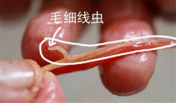 寄生虫病防治的三个基本原则 寄生虫病防治的三个基本原则