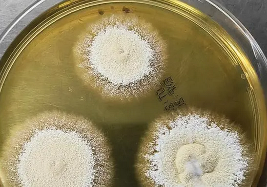 家养宠物的注意了!益阳3岁女孩头顶长出一片“蘑菇”,竟是宠物兔惹的祸 家养宠物的注意了!益阳3岁女孩头顶长出一片“蘑菇”,竟是宠物兔惹的祸