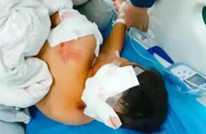 回顾：闹大了！10岁男孩被猎犬咬进ICU，血肉模糊！狗主人该如何？