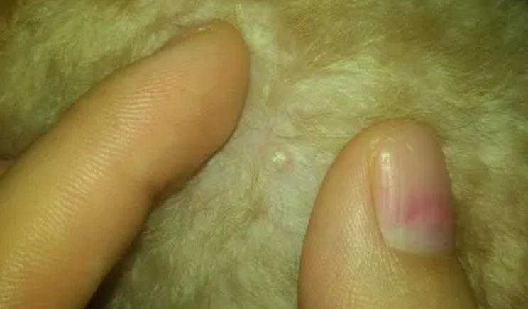 长瘊子是感染了hpv吗 长瘊子是感染了hpv吗