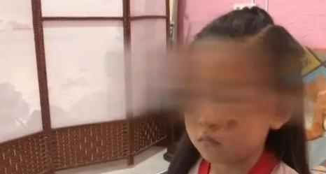 河北一女童被狗绊倒摔破脸,狗主人竟嫌医药费贵,坚持走司法程序 河北一女童被狗绊倒摔破脸,狗主人竟嫌医药费贵,坚持走司法程序