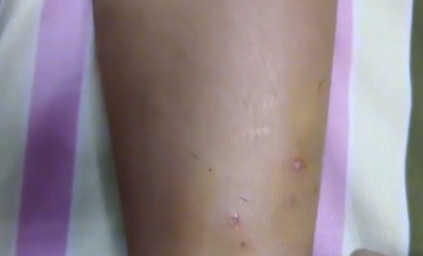广东湛江:狗未牵绳咬伤三名儿童,狗主人叫嚣法院告他 广东湛江:狗未牵绳咬伤三名儿童,狗主人叫嚣法院告他