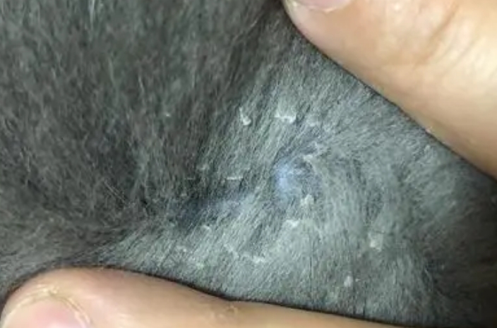 正常皮屑和猫藓皮屑的区别