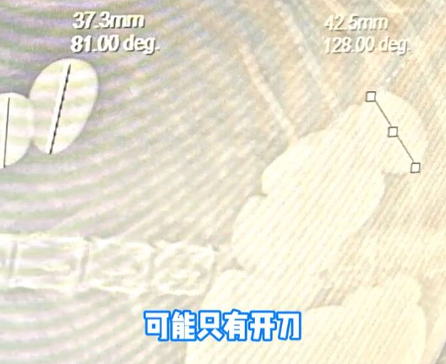 20多颗!成都一狗狗吐绿色胆汁,检查发现石头,竟因一个不良习惯 20多颗!成都一狗狗吐绿色胆汁,检查发现石头,竟因一个不良习惯