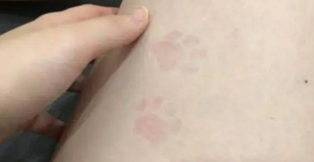 猫咪实在是太胖了,在铲屎官腿上坐了一会后,竟然印上了爪子印 猫咪实在是太胖了,在铲屎官腿上坐了一会后,竟然印上了爪子印