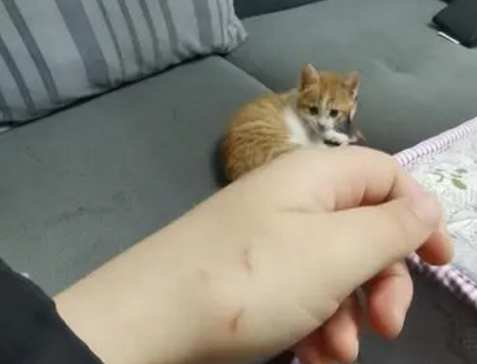 张文宏说被猫咬不打疫苗