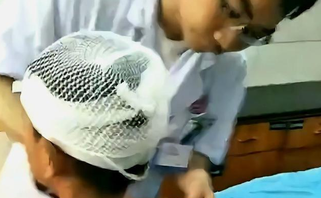 江西吉安一8岁男童在街头被一只狗扑倒咬伤,脸部伤口长达15厘米 江西吉安一8岁男童在街头被一只狗扑倒咬伤,脸部伤口长达15厘米