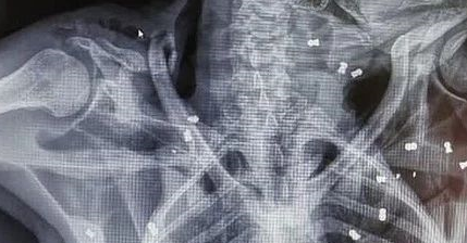 母猩猩身中74弹倒下,双眼失明、孩子脱水而死,凶手仍未找到 母猩猩身中74弹倒下,双眼失明、孩子脱水而死,凶手仍未找到