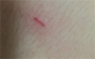 让猫爪子蹭破一点皮没事吧