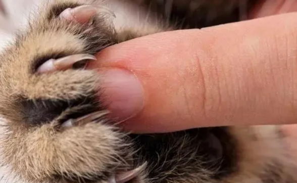 被猫抓一下高烧14天,流浪猫有多危险? 被猫抓一下高烧14天,流浪猫有多危险?