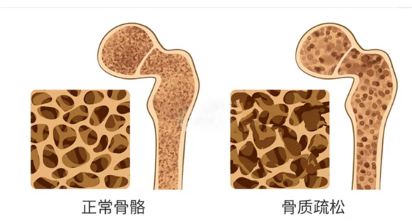 蓝跃纯鳕鱼肝油，您的补钙好搭档！