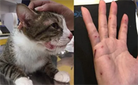 猫抓皮伤图片