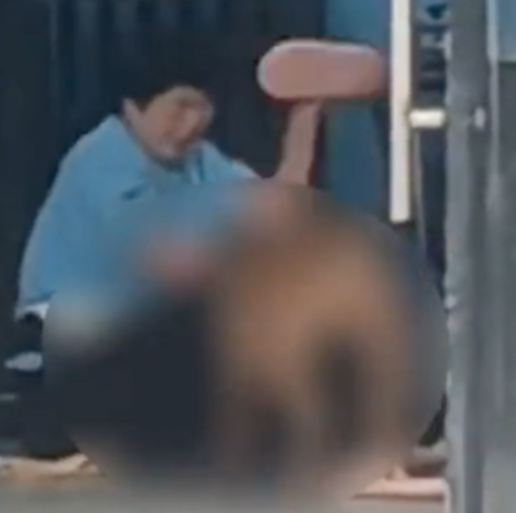 大妈看狗饿了擅自去喂食，结果被狗撕咬受伤