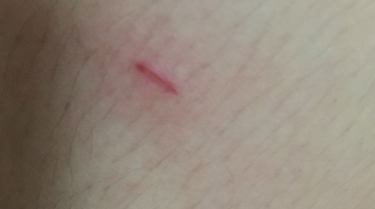 让猫爪子蹭破一点皮没事吧