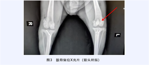推荐阅读 | 犬髌骨脱位治疗经验分享 推荐阅读 | 犬髌骨脱位治疗经验分享