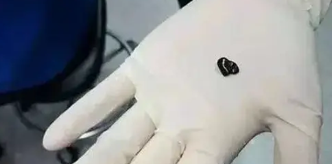 金鱼生病带去做手术,最后一问治疗费用,顿时肠子都悔青了! 金鱼生病带去做手术,最后一问治疗费用,顿时肠子都悔青了!