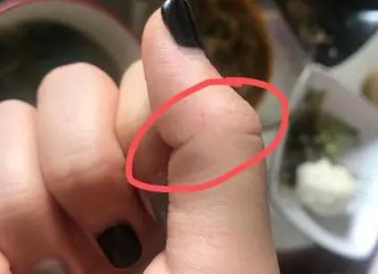 2个月小猫抓破皮要紧吗 2个月小猫抓破皮要紧吗