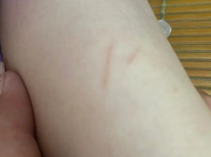 2个月幼猫抓了会得狂犬病吗