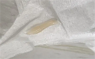 猫咪肛门爬出白色虫子