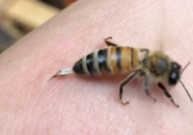 被蜂子蜇怎么办