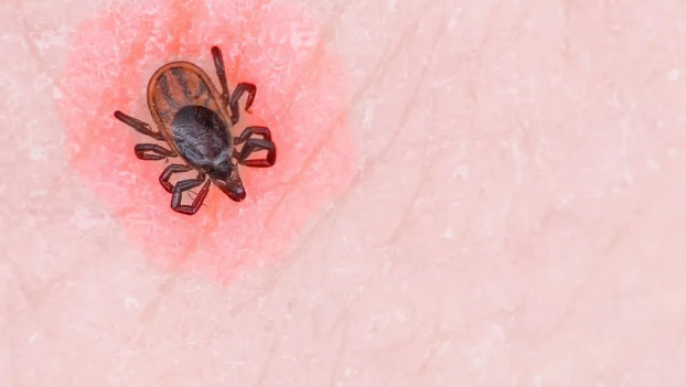 小小的蜱虫，为何能致人死亡？