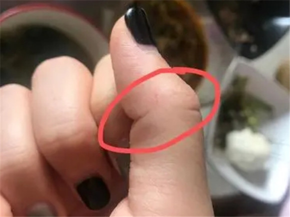 被一个月的小猫抓破皮