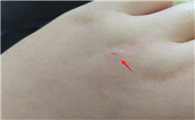 被猫抓了肉眼几乎看不到伤口
