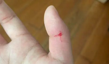 被满月小猫抓了浅浅的划痕