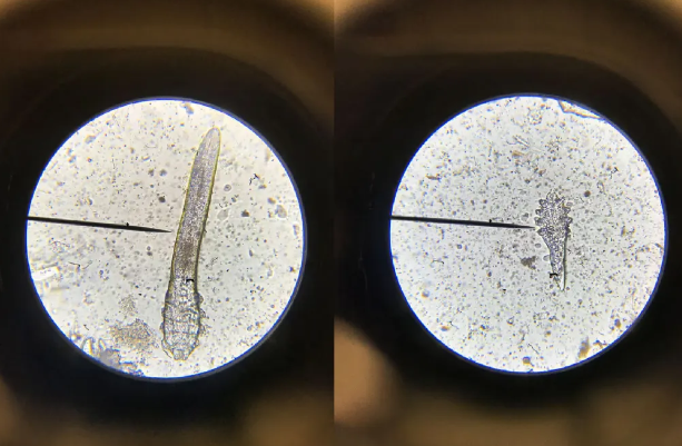 床上毛毯上的螨虫怎么除掉