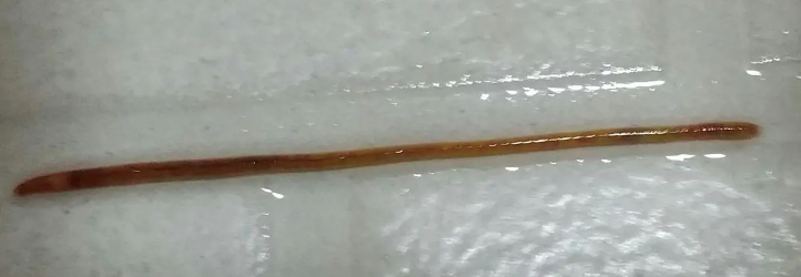 卫生间下水道有蚯蚓怎么办