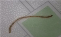 下水道有蚯蚓爬出来怎么办