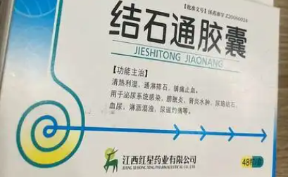 佑财结石通片多少钱