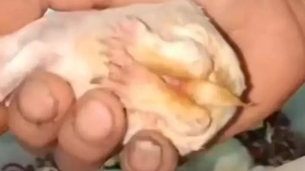 幼免黄尿病是什么引起的 幼免黄尿病是什么引起的