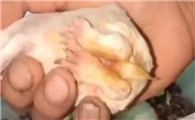 幼免黄尿病是什么引起的