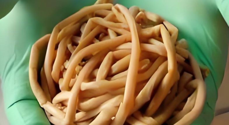 儿童蛔虫和蛲虫有什么区别