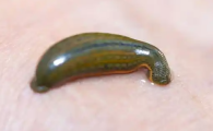 井水有蚂蟥怎样处理