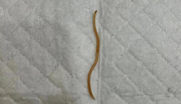 儿童肚里有蛔虫有什么症状