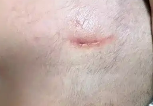 1岁萌娃突遭宠物狗扑咬!头面部多处撕裂紧急送医 1岁萌娃突遭宠物狗扑咬!头面部多处撕裂紧急送医