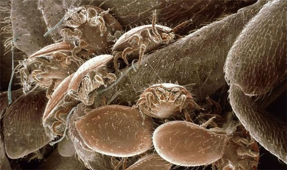 对螨虫过敏有什么症状 对螨虫过敏有什么症状