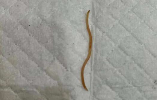 蛔虫为雌雄同体的动物