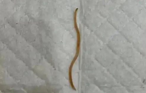什么季节打虫子肚子里的蛔虫