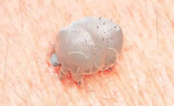 床上经常有螨虫怎么办