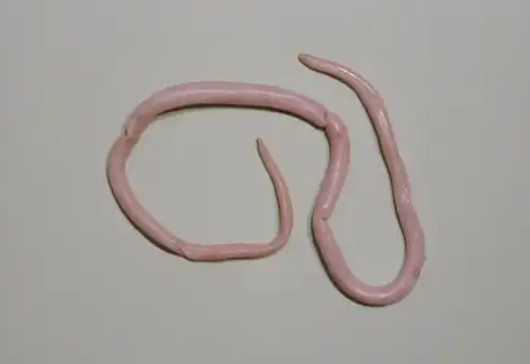 儿童肚子里有蛔虫有什么症状