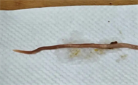 蛔虫是线形动物还是环节动物