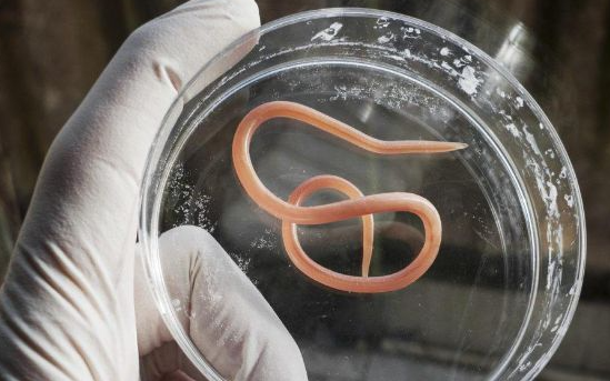 肚子没有蛔虫可以吃蛔虫药吗 肚子没有蛔虫可以吃蛔虫药吗