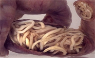 成人有蛔虫是什么症状